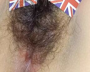 England hairy